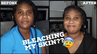 AM I BLEACHING MY SKIN? | Underneath Skincare Update