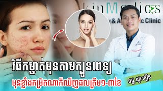 introl2ប្រើគ្រប់វិធីនៅតែមិនបាត់មុន មកសាកក្បួនពេទ្យម្តង មិនថាមុនជ្រៅកម្រិតណាត្រឹម1-3ខែឃើញលទ្ធផល