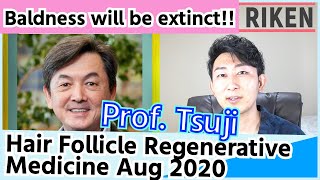 【Aug 2020】Baldness will be extinct_Hair Loss Treatment_Hair Follicle Regeneration Medicine