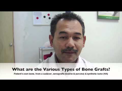 Bone Graft 101 Latest Version Youtube