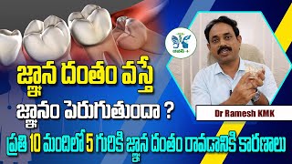 జ్ఞాన దంతం అంటే ఏమిటి? ఎందుకు వస్తుంది? | When to Remove Wisdom Teeth in Telugu | Wisdom Teeth Pain