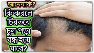 মাত্র ৭ দিনে চুল পড়া বন্ধ হবে চিরতরে || The Way to Stop Hair fall