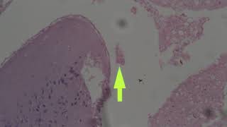 0126 Demo (Episode5) Nerve System for M115