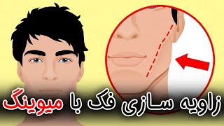 زاویه سازی فک بدون تزریق ژل و یا عمل زاویه سازی صورت (۳۱۹)