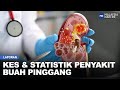 Laporan: Kes & Statistik Penyakit Buah Pinggang | MHI (7 Mac 2023)