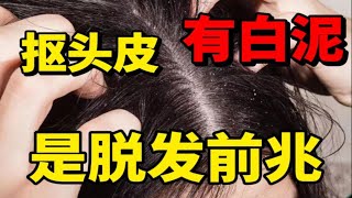 【头皮除螨】螨虫引发的头皮问题，一瓶洗发水就搞定！