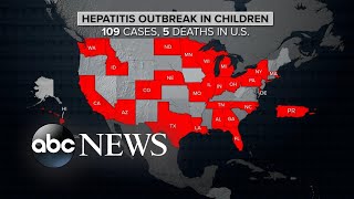 CDC issues new global alert on hepatitis cases in children | ABCNL
