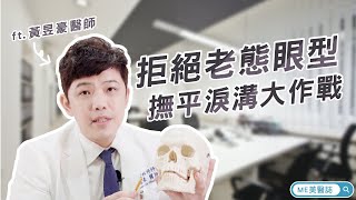 眼袋｜撫平淚溝大作戰 淚溝若合併眼袋治療方式一樣嗎？ft.整型外科黃昱豪醫師【ME美醫誌】