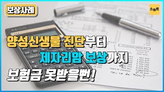 내시경 검사 결과 양성신생물이라고 했는데, 제자리암 진단비를 받았습니다.(61회)