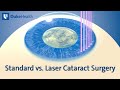 Standard vs. Laser Cataract Surgery | Duke Health