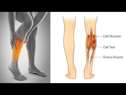 How to Stop Leg Muscle Cramps How to Stop Leg Muscle Cramps
