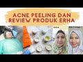 Klinik ERHA No Acne No Cry Program Untuk Pejuang Acne | Review Pemakaian Produk ERHA