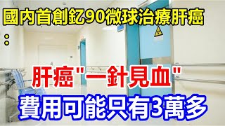 l國內首創釔90微球治療肝癌： 肝癌 \