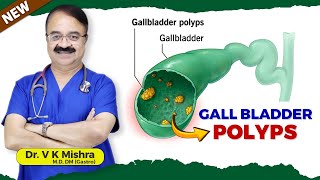 GALL BLADDER POLYPS #polyps