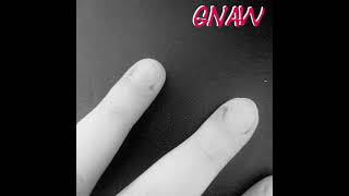 GNAW - a song about Dermatophagia