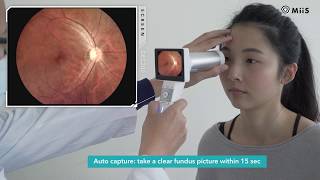 Horus DEC 200 Digital Eye fundus camera ∣ Condensed version｜MiiS