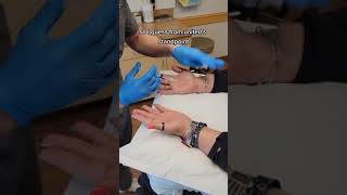 SWEATY HANDS? Here's how a dermatolgoist performs botox to help with hyperhydrosis of the hands!