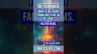 MS and Vision Loss: The Spinal Connection