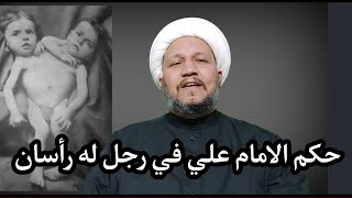 حكم الامام علي عليه السلام في رجل له رأسان في جسم واحد