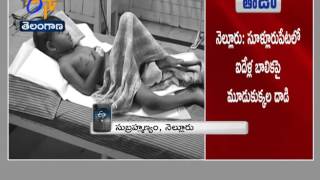 Stray Dogs Attack On 5 Year Old Kid in Sullurpet of Nellore Dist