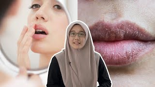 Elakkan Jilat Bibir yang Kering