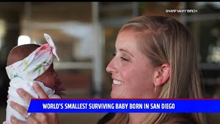 World`s Smallest Baby Born In San Diego