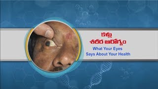 Aarogyamastu | WhatYourEyesSaysAboutHealth | 10th August 2017 | ఆరోగ్యమస్తు