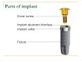 PARTS OF DENTAL IMPLANT