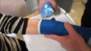 Taking cast of artist broken wrist,  and home 3rd video