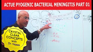 Acute Pyogenic Bacterial Meningitis Part 1 🩺