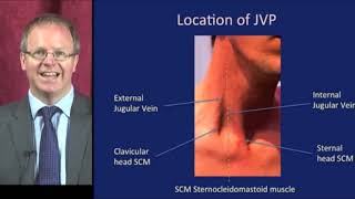 Jugular Venous Pressure (JVP)