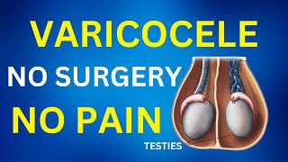 Cure Testis Pain Naturally Without Surgery | Natural Treatment For Varicocele Pain Relief