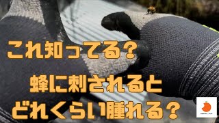 蜂に刺されるとどれくらい腫れる？刺されたときの対処法は？実体験を元に解説