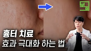 흉터 치료는 이렇게까지 해야 좋아집니다 (ft. 스킨부스터)