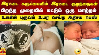 இரட்டை கருப்பையில் இரட்டை குழந்தைகள்.. பிறந்த முறையில் மட்டும் ஒரு மாற்றம்