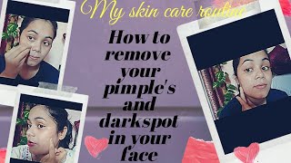 My skin transformation journey দুবছৰত কেনেকৈ মই মোৰ skin খন ভাল কৰিলো pimples আৰু ক'লা দাগৰ পৰা 😥😥