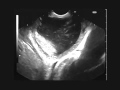 Upper Gastrointestinal Endoscopy and Endoscopic Ultrasonography