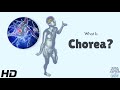 What Is Chorea? The Mysterious Dance of the Nervous System