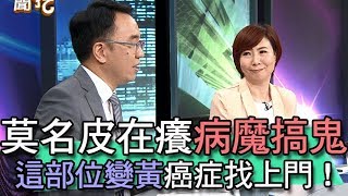 【精華版】得癌症莫名皮在癢       這部位變黃是身體在求救！