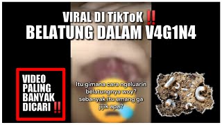 Mxtube.net :: Viral tiktok belatung di vagina Mp4 3GP Video & Mp3 ...