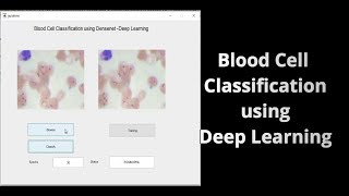 Blood Cell Classification using Deep Learning