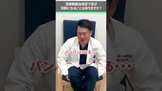 深部静脈血栓症で足が切断になることはありますか？ #下肢静脈瘤 #血栓 #shorts