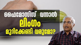 ഫൈമോസിസ്  വന്നാൽ ലിംഗം മുറിക്കേണ്ടി വരുമോ? | sexualhealth matters  | dr promodu