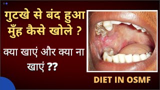 DIET IN OSMF  क्या खाएं और क्या ना खाएं ??