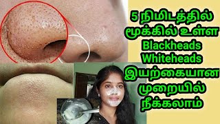 Remove Blackheads \u0026Whiteheads In just 5minits at home | முகத்தில் உள்ள கரும்புள்ளி நீங்க எளிய வழி