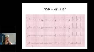 Cardiology - ECG in ED - Dr A McCorquodale - 10Nov2020