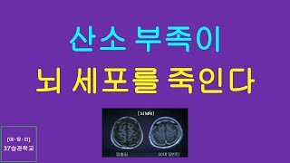 매탐인 망각 - 산소 부족으로 뇌가 위축된 엄홍길 산악의 뇌