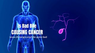 Bile Gone Bad: The Rising Incidence of Bile Duct Cancer