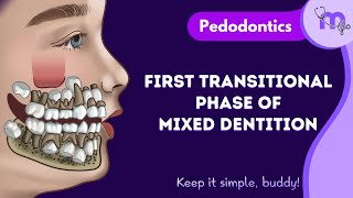 First Transitional Phase of Mixed Dentition | Pedodontics | Animated Explanation