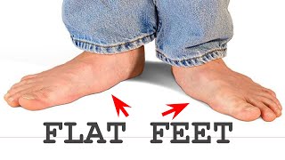 Do I need Orthotics? (Flat Feet/Collapsed Arch)